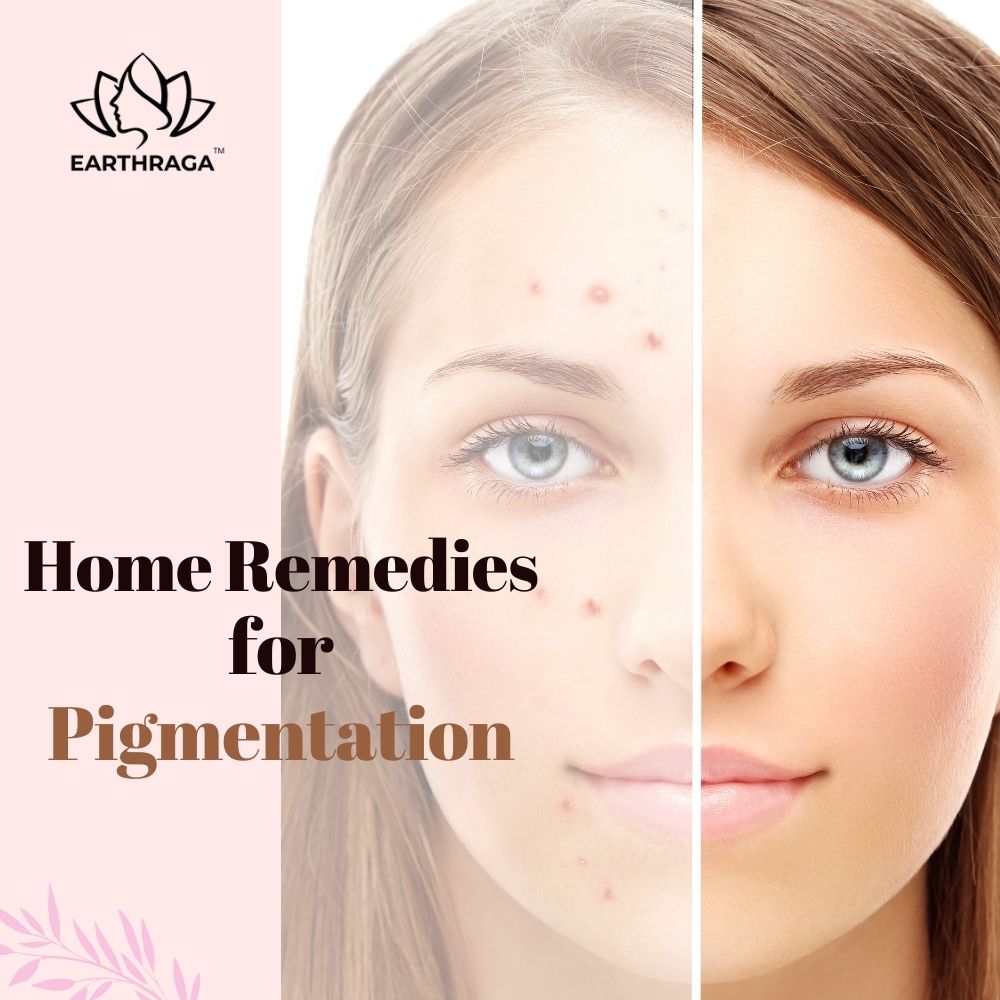 home remedies for pigmentation